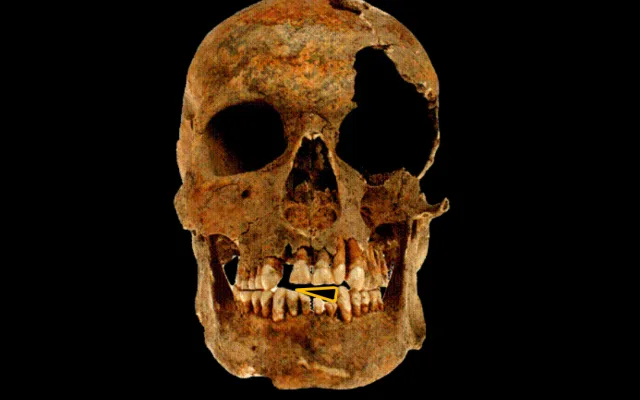 Voják z Majetína používal zuby k otevírání nábojů. Olomoučtí archeologové přišli s unikátním zjištěním