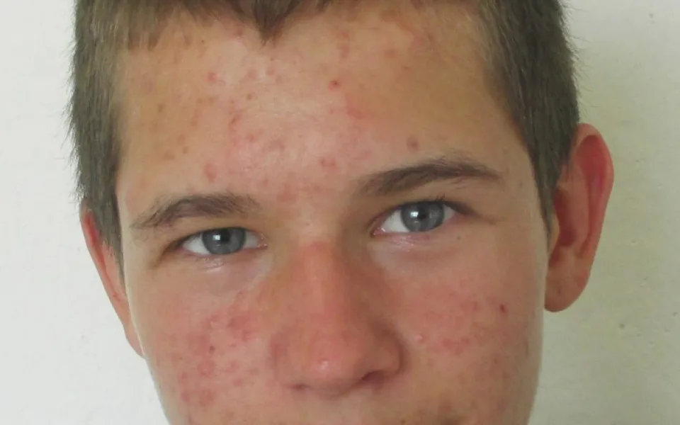 zdroj: PČR