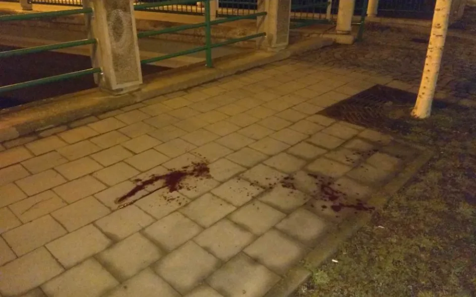 Muže v centru napadla  šestice cizinců, vyvázl s krvavým zraněním