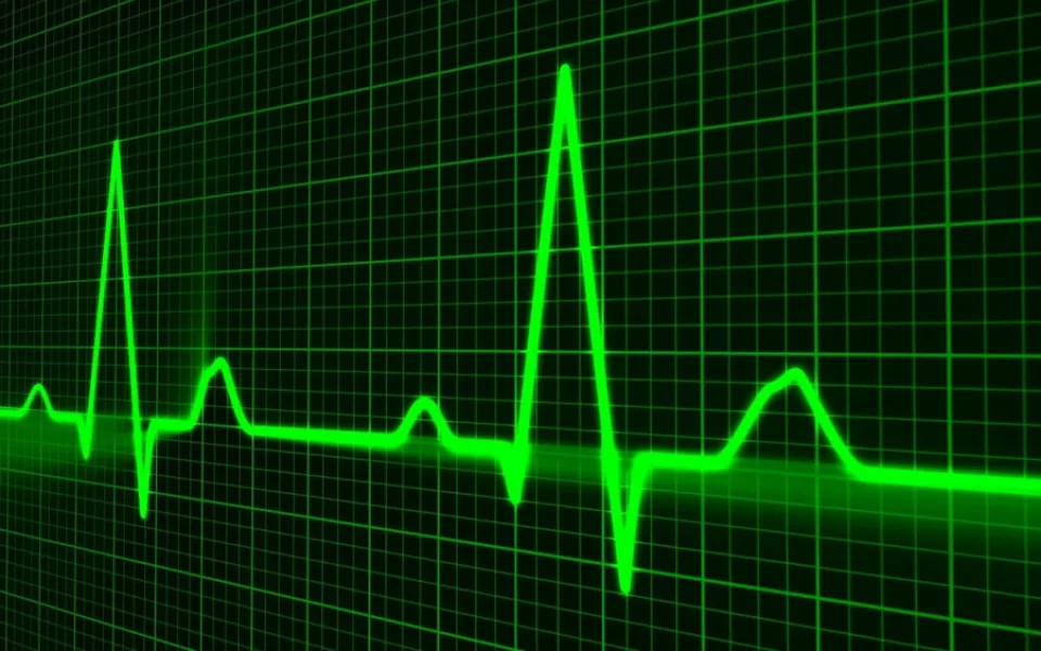 pulse-trace-163708_1280