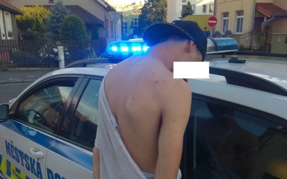 Mladík se snažil uklidnit hromadnou bitku. Odnesl to zraněnou rukou a nohou