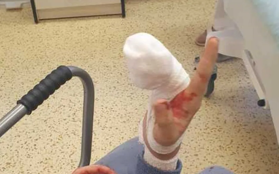 Chlapec ve skateparku přišel o část prstu. Do nemocnice ho vezli strážníci