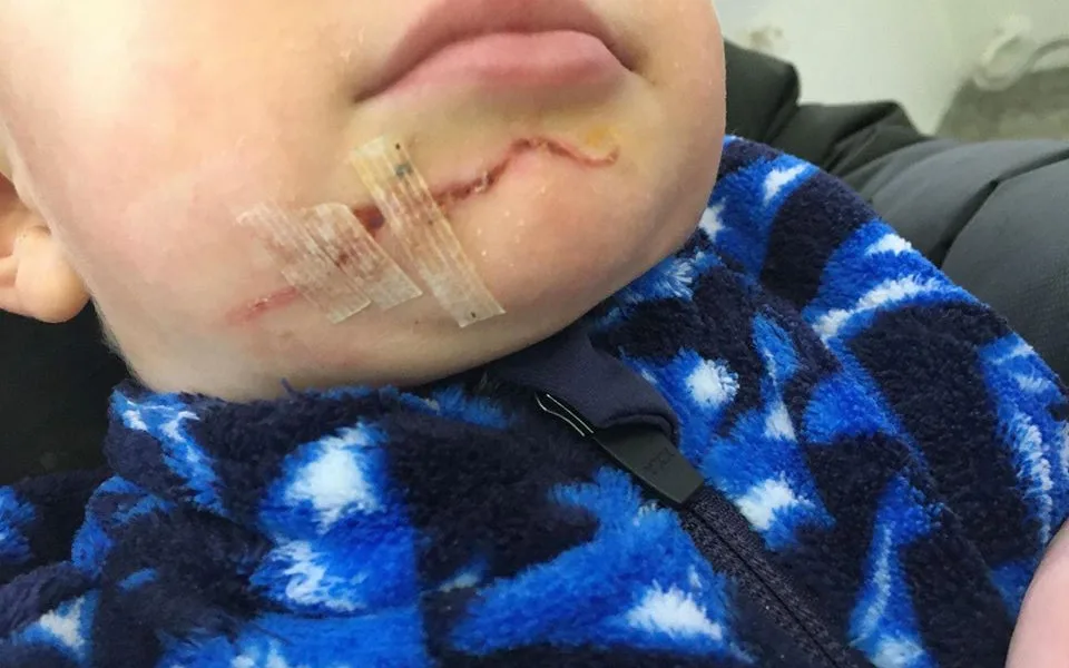 Policie žádá o pomoc svědky, kteří byli na Silvestra ve ski areálu Kouty nad Desnou