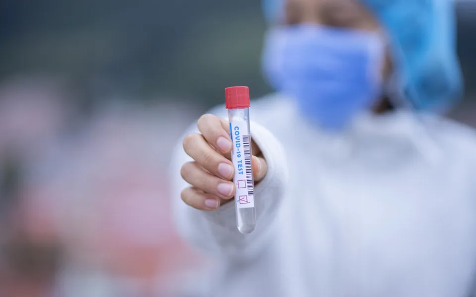 covid19, koronavirus, případy testy
