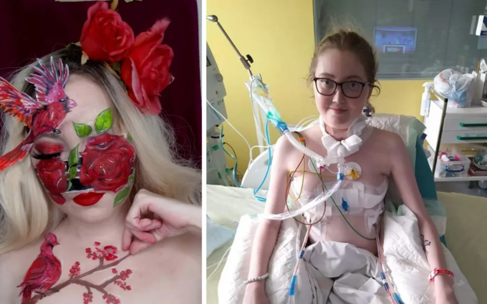 Jsem fénix, který vstal z popela, říká mladá žena po re-transplantaci
