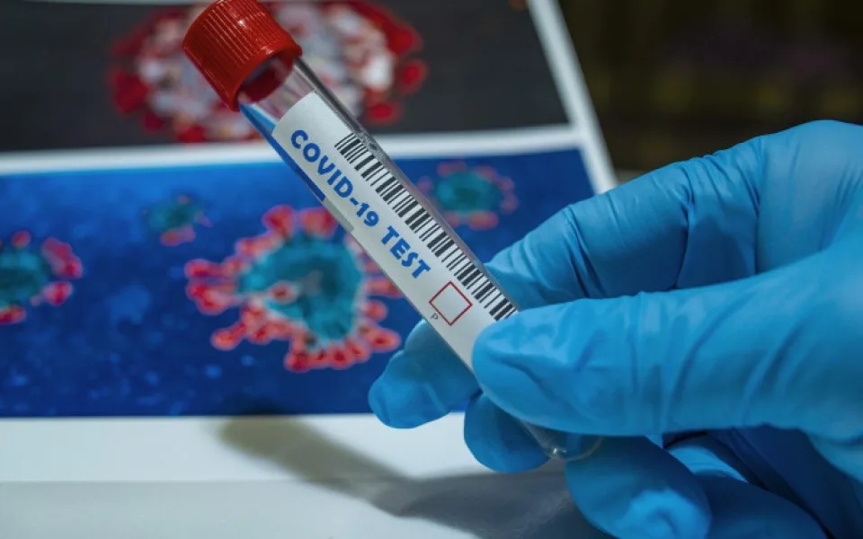 Epidemie brzdí. V Olomouckém kraji poprvé od srpna klesl týdenní přírůstek