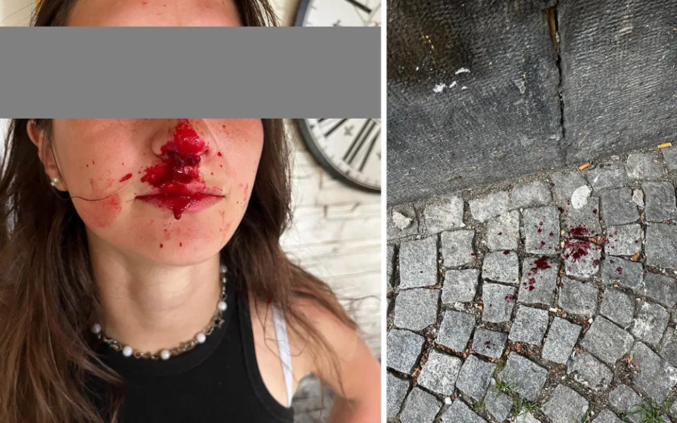 Napadení nezletilé dívky ve Šternberku vyšetřuje policie, město řeší dlouhodobé nevhodné chování skupiny obyvatel