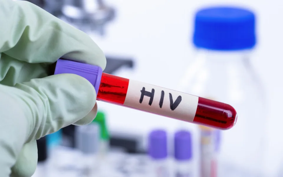 HIV_ilustracni